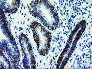 Anti-SOCS3 Mouse Monoclonal Antibody [clone: OTI8G3]
