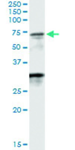 Anti-WDR20 Polyclonal Antibody Pair