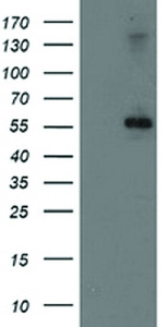 Anti-PPM1B Mouse Monoclonal Antibody [clone: OTI2D9]