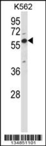 Anti-OXSR1 Rabbit Polyclonal Antibody (HRP (Horseradish Peroxidase))