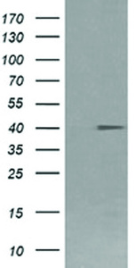 Anti-FCGR1A Mouse Monoclonal Antibody [clone: OTI3D3]