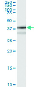 Anti-TP53I3 Polyclonal Antibody Pair