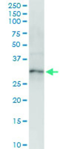 Anti-XBP1 Polyclonal Antibody Pair