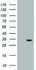 Anti-UCK1 Mouse Monoclonal Antibody [clone: OTI7E11]