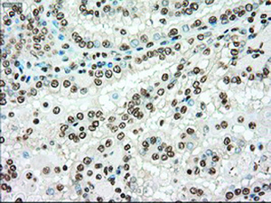 Anti-TYRO3 Mouse Monoclonal Antibody [clone: OTI2C4]
