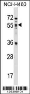 Anti-MEX3B Rabbit Polyclonal Antibody (FITC (Fluorescein Isothiocyanate))