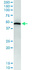 Anti-STAT5B Mouse Monoclonal Antibody