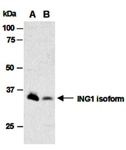 Western blot analysis of whole cell extracts from human Hela(Lane1) and human MCF7 using ING1 antibody