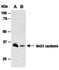 Western blot analysis of whole cell extracts from human Hela(Lane1) and human MCF7 using ING1 antibody