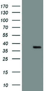 Anti-SNAI2 Mouse Monoclonal Antibody [clone: OTI1H10]