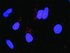 Anti-STAT5A + GHR Antibody Pair