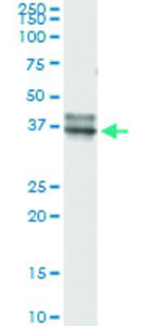 Anti-OLIG2 Antibody Pair