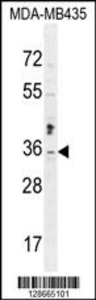 Anti-MTX2 Rabbit Polyclonal Antibody (HRP (Horseradish Peroxidase))