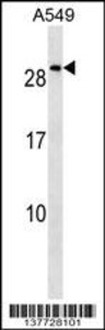 Anti-NKX2-8 Rabbit Polyclonal Antibody (HRP (Horseradish Peroxidase))