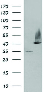 Anti-SERPINB3 Mouse Monoclonal Antibody [clone: OTI2B9]