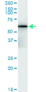 Anti-OMD Polyclonal Antibody Pair