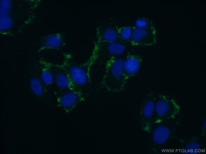 Anti-ABCB6 Rabbit Polyclonal Antibody