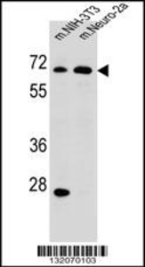 Anti-ME2 Rabbit Polyclonal Antibody (FITC (Fluorescein Isothiocyanate))