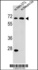 Anti-ME2 Rabbit Polyclonal Antibody (FITC (Fluorescein Isothiocyanate))