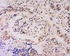 Immunohistochemical staining of human kidney tissue using Glutaredoxin 1 antibody.