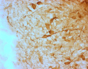 Anti-Mouse AGRP Guinea Pig Polyclonal Antibody