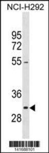 Anti-NIFK Rabbit Polyclonal Antibody (FITC (Fluorescein Isothiocyanate))