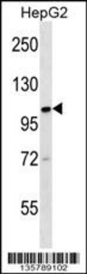 Anti-KIF18A Rabbit Polyclonal Antibody (HRP (Horseradish Peroxidase))