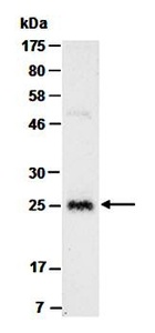 Western blot analysis of total cell extracts from mouse bone marrow using GR1 antibody