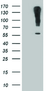 Anti-SLC7A8 Mouse Monoclonal Antibody [clone: OTI7C2]