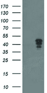 Anti-NUDT9 Mouse Monoclonal Antibody [clone: OTI5B5]