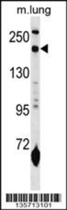 Anti-MRC1L1 Rabbit Polyclonal Antibody