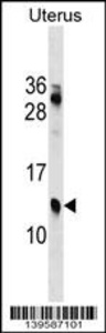 Anti-KLKP1 Rabbit Polyclonal Antibody (FITC (Fluorescein Isothiocyanate))