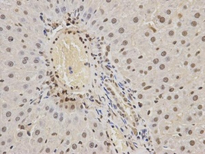 IHC-P staining of rat brain tissue using HNRNPK antibody (primary antibody dilution at 1:200)