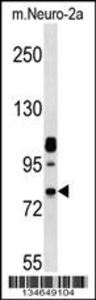 Anti-NEK8 Rabbit Polyclonal Antibody