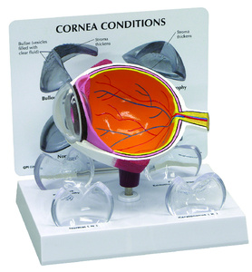 GPI Anatomicals® Cornea Eye Model