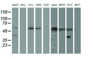 Anti-AP2M1 Mouse Monoclonal Antibody [clone: OTI1C8]