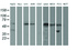 Anti-AP2M1 Mouse Monoclonal Antibody [clone: OTI1C8]