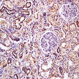 Immunohistochemical analysis of formalin-fixed and paraffin embedded human kidney tissue (dilution at:1:200) using DDIT4L antibody