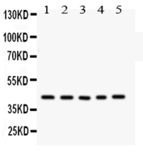 Anti-CCN1 Rabbit Polyclonal Antibody