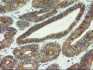 Anti-CTNNB1 Mouse Monoclonal Antibody [clone: OTI1B11]