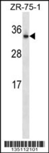 Anti-OTUB2 Rabbit Polyclonal Antibody (APC (Allophycocyanin))