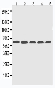 Anti-CYP2U1 Rabbit Polyclonal Antibody
