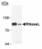 Anti-RNASEL Mouse Monoclonal Antibody [clone: 2E9]