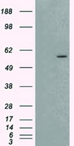 Anti-AKT2 Mouse Monoclonal Antibody [clone: OTI1A2]