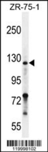 Anti-NRP2 Rabbit Polyclonal Antibody (AP (Alkaline Phosphatase))