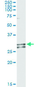 Anti-NDUFS3 Antibody Pair