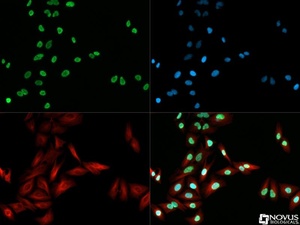 Anti-ABCF2 Rabbit Polyclonal Antibody