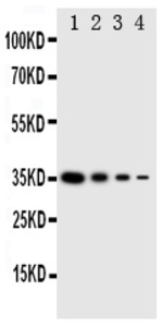 Anti-PKR Rabbit Polyclonal Antibody
