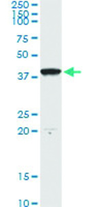 Anti-DNAJB4 Antibody Pair