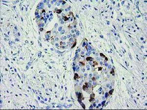 Anti-RGS5 Mouse Monoclonal Antibody [clone: OTI1C1]